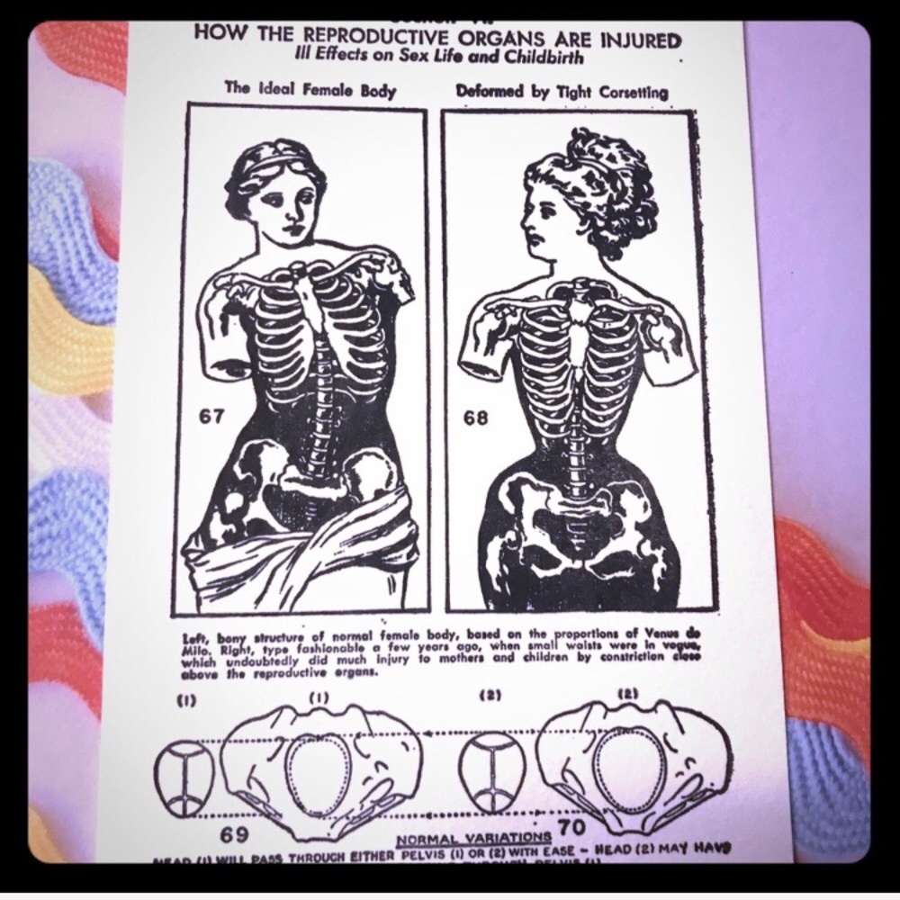 Handmade Letterpress Anatomy Print – Vintage Female Body Study l